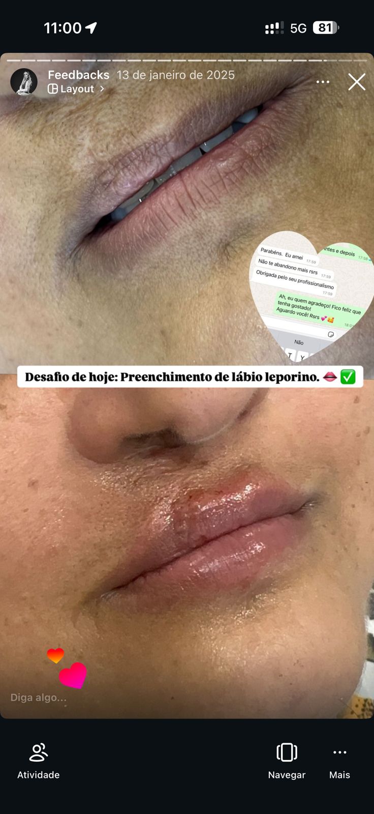 Feedback paciente
